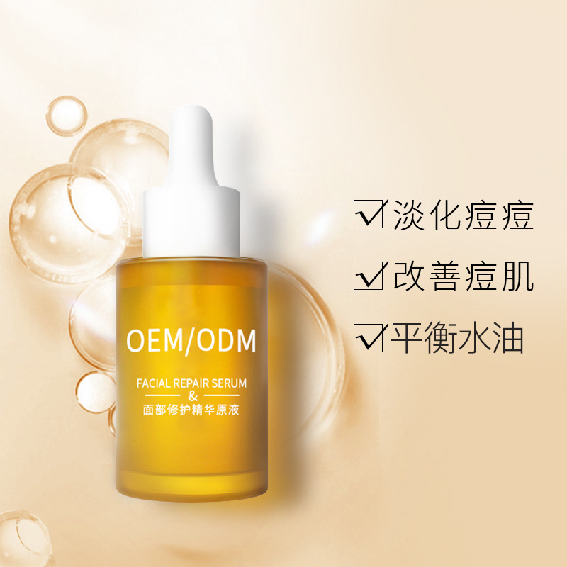 巴南区_祛痘精华原液OEM